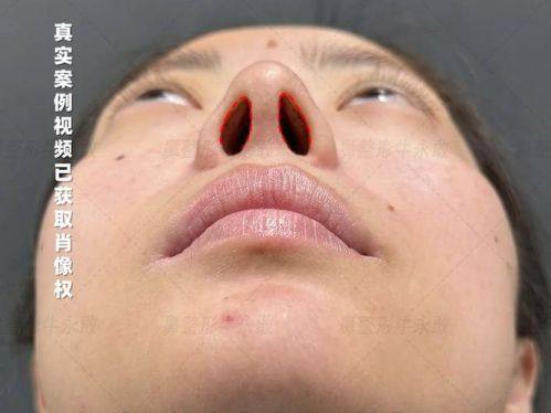 桂林时光医疗美容怎么样？