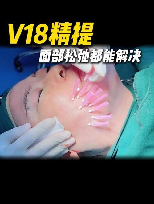 郑州二七妍琳医疗美容门诊部擅长项目