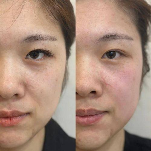 深圳亚太整形医疗美容门诊部怎么样？