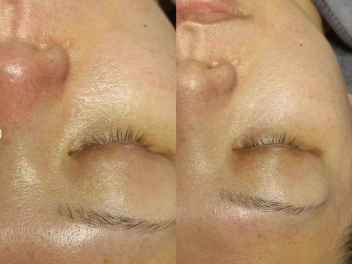 深圳亚太整形医疗美容门诊部预约挂号方式：