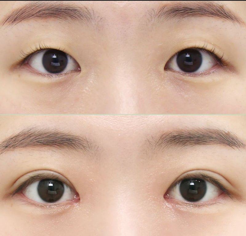 常宁越美整形美容医院怎么样?